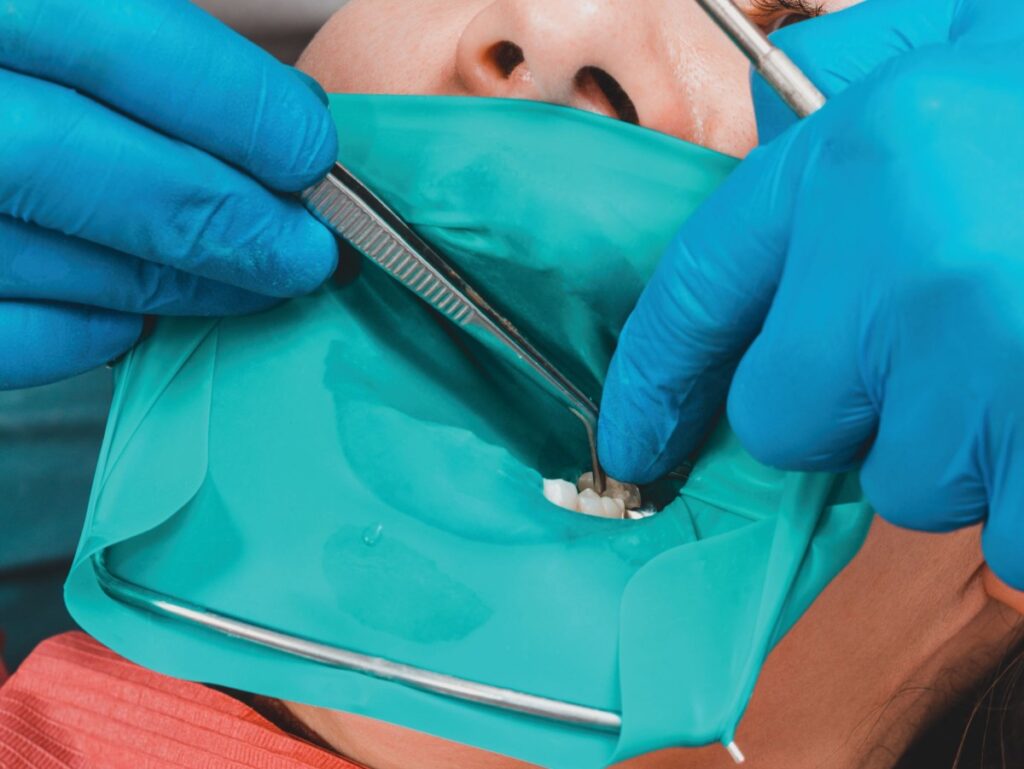 How Can Dentists Master Dental Dam Placement Techniques?